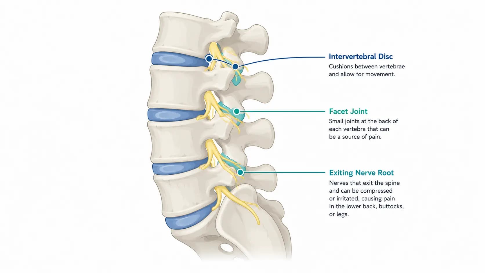 Low Back Pain anatomy illustration