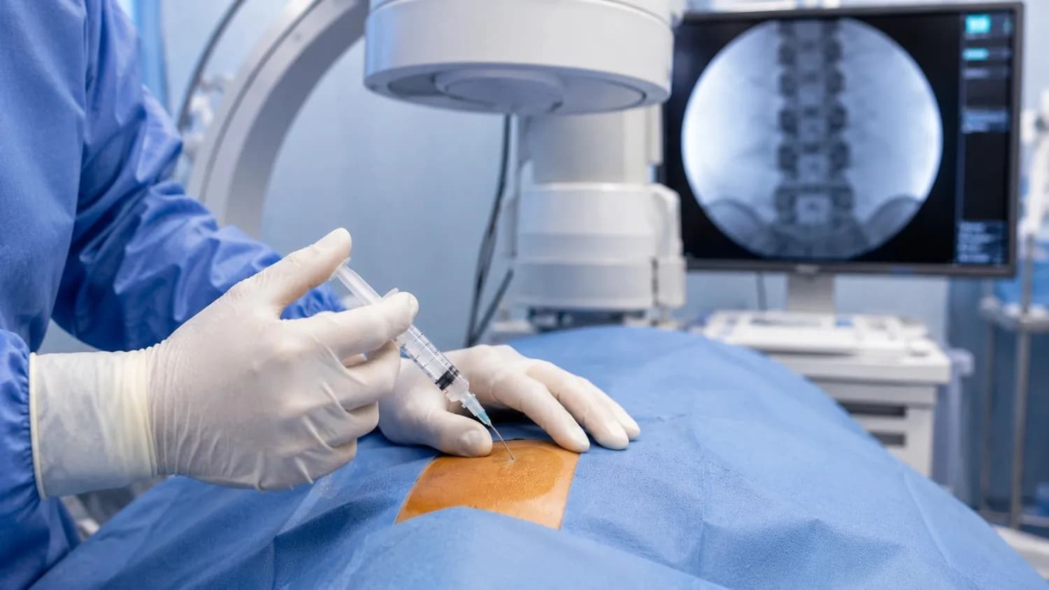 Epidural Steroid Injections procedure
